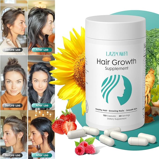Hair Growth Products, Biotin 10000mcg, 30-in-1 with Vitamin A, B3, C, D, E, Calcium, Hair Growth Supplement, Supports Hair & Nails Natural Growth Vitamins, for Women & Men - 60 Servings