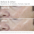 SkinMedica Total Defense + Repair SPF 34 Sunscreen for Face. This Lightweight, Facial Sunscreen is Ideal for Oily and/or Combination Skin, 2.3 Oz