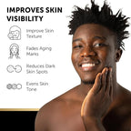 VALITIC Kojic Acid Vitamin C and Retinol Soap Bars with Turmeric for Dark Spot - Original Japanese Complex Infused with Collagen, Hyaluronic Acid, and Vitamin E (3 Pack)