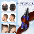 5% Minoxidil Hair Growth for Men and Women: 4-Pack Extra Strength Minoxidil Hair Loss Treatment Serum with Rosemary for Faster Stronger Thicker Hair Growth - 240 ML