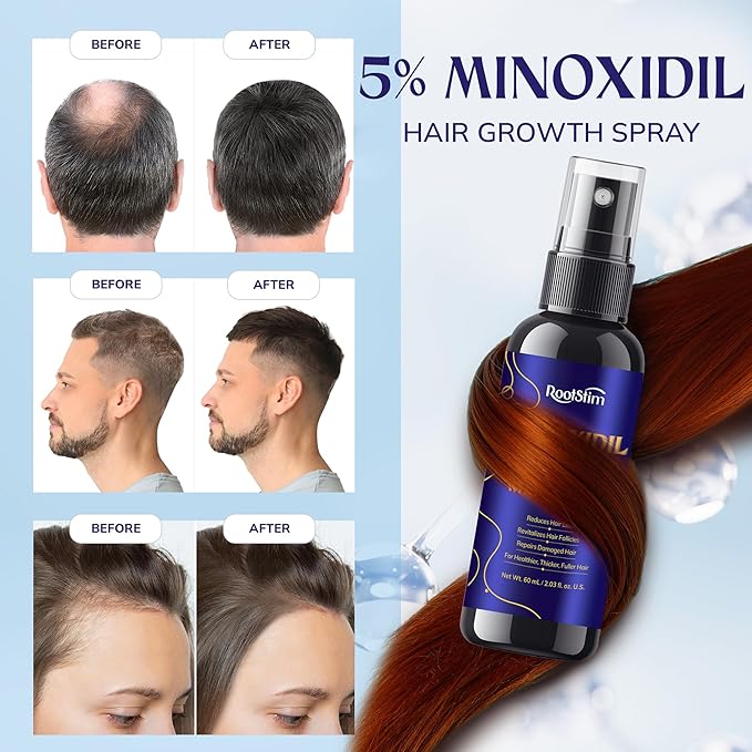 5% Minoxidil Hair Growth for Men and Women: 3-Pack RootStim Extra Strength Minoxidil with Rosemary for Thinning Hair Regrowth and Fuller Hair 180 ML