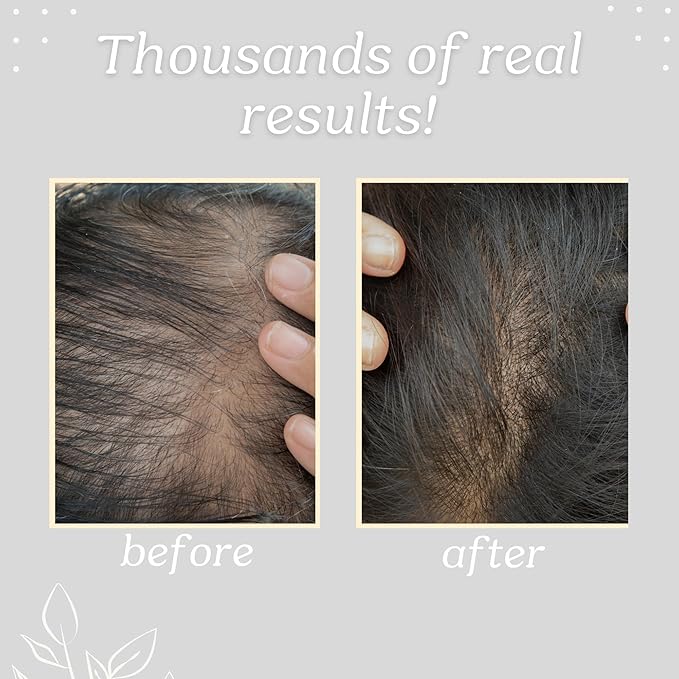 Honduran Batana Oil for Promoting Hair Strength & Wellness | 100% Pure & Natural Hair Growth Oil for Men & Women