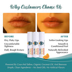 Moisturizing Tallow Lip Balm – Grass-Fed Beef Tallow with Organic Coconut Oil, Beeswax, and Vitamin E – Sweet Orange – Lip Balm Set – Travel Essential – 3-Pack