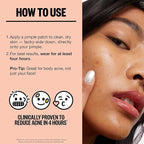 PEACE OUT Acne Day & Night Duo, Sheer Hydrocolloid Pimple Patches For Day Plus Overnight Acne Dots, Helps Clear Blemishes Quickly with Salicylic Acid, Retinol and Aloe Vera, 20 dots