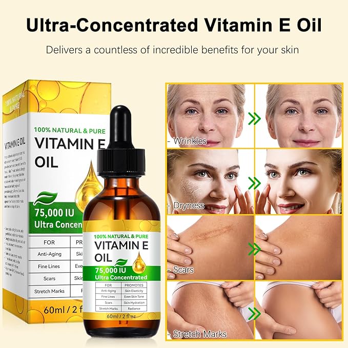 Pure Vitamin E Oil, 75,000 IU Ultra Concentrated & Natural for Stretch Mark/Scars Treatment, Smoothing & Moisturizing Skin & Hair & Cuticles, Cold Pressed/Hexane Free/Non-GMO, 60ML/2Fl Oz