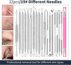 22 Pcs Pimple Popper Tool, Blackhead Remover Acne and Zit Comedone Extractor Kit