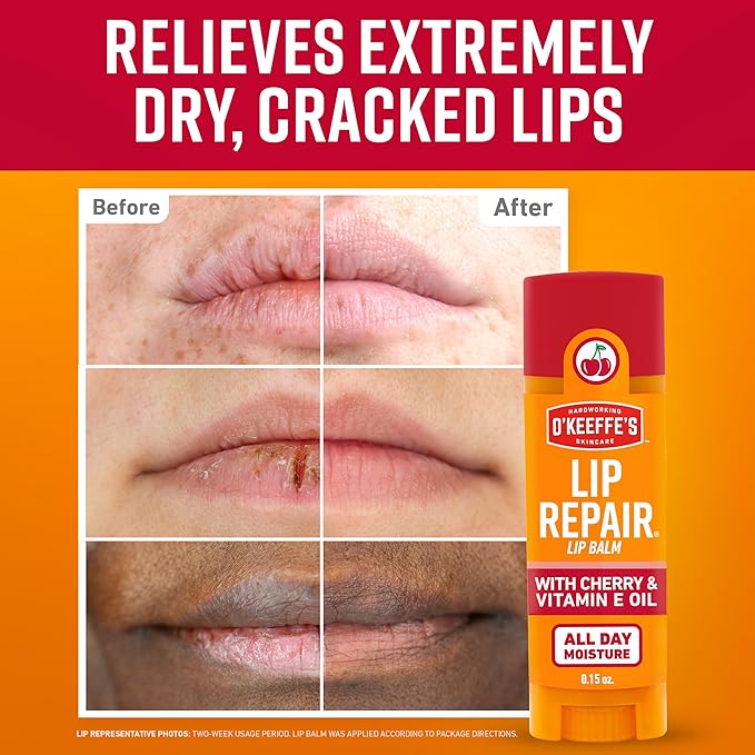 O'Keeffe's Lip Repair Lip Balm with Cherry & Vitamin E Oil - Stick (Twin Pack) - Moisturizer for Extremely Cracked, Dry Lips