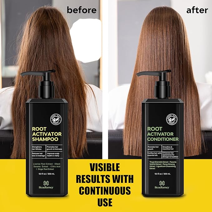 Root Activator Shampoo and Conditioner for Men: Hair Growth Set for Hair Loss and Thinning Hair