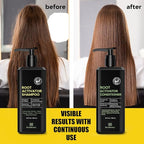 Root Activator Shampoo and Conditioner for Men: Hair Growth Set for Hair Loss and Thinning Hair