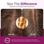 Minoxidil for Women 5% Foam - Helps Restore Top of Scalp Hair Loss and Support Hair Growth for Women, Regrowth with Unscented Topical Treatment for Thinning Hair (5% Foam 4-Month Supply)