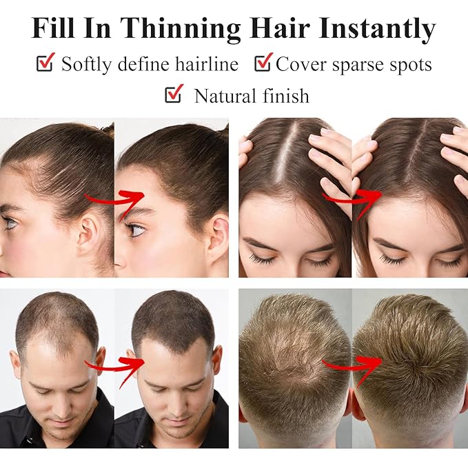 VOLLUCK Root Touch up Powder, Long-lasting Gray Hair Cover up Powder for All Hair Types, Waterproof for Women and Men (Medium-Brown, 0.42 0unce)