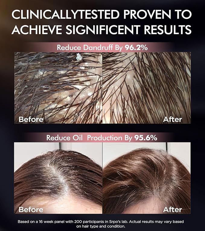 Dual Essence Hair Growth Shampoo and Conditioner Set with Biotin&Tripeptide, 3X Moisturizing Biotin Shampoo for Softer Shiner Hair, Anti-Loss Dandruff Routine Rosemary Shampoo for Men Women, 2x16.9oz