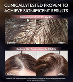 Dual Essence Hair Growth Shampoo and Conditioner Set with Biotin&Tripeptide, 3X Moisturizing Biotin Shampoo for Softer Shiner Hair, Anti-Loss Dandruff Routine Rosemary Shampoo for Men Women, 2x16.9oz