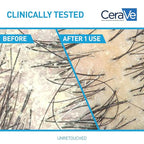 CeraVe Hydrating Anti Dandruff Shampoo, 1% Pyrithione Zinc Dandruff Treatment With Ceramides, Niacinamide & Hyaluronic Acid, Helps Eliminate Flakes & Provides Itchy Scalp Relief, Sulfate Free, 19 Oz