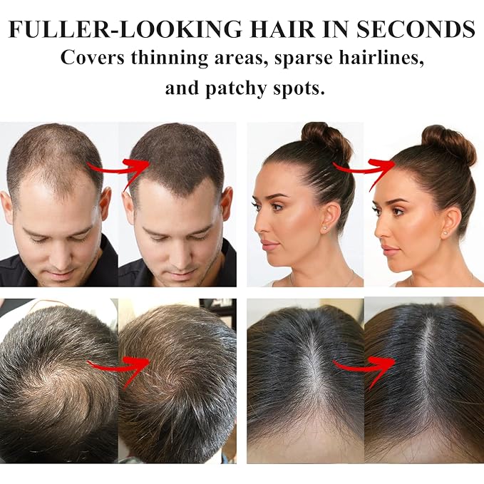 VOLLUCK Root Touch up Powder, Instant Hairline Powder for Thinning Areas and Gray Hair Coverage, Natural and Non-greasy Root Cover up for Women and Men (Red Brown, 0.35 Ounce)