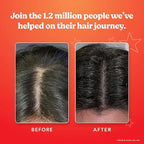 HAIRtamin Scalp Serum | Visibly Thicker, Nourished Hair and Healthy Scalp Treatment (Two Pack)