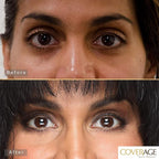 Jerome Alexander CoverAge Concealer Stick - Anti-Aging Under Eye Concealer + Skincare - Brighten Dark Circles, Hydrate, and Nourish - Medium Dark