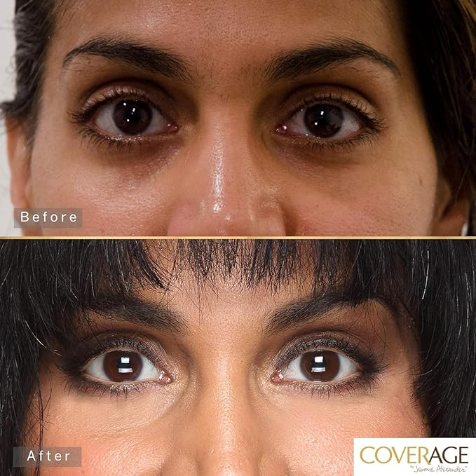 Jerome Alexander CoverAge Concealer Stick - Anti-Aging Under Eye Concealer + Skincare - Brighten Dark Circles, Hydrate, and Nourish - Medium Dark