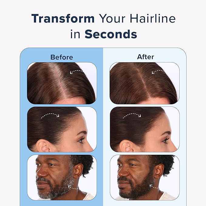 TRUHAIR Color & Conceal Waterproof Root Touch Up - Hair Cover Up for Gray Coverage and Hairline Filling - 11 Colors Available (Auburn)