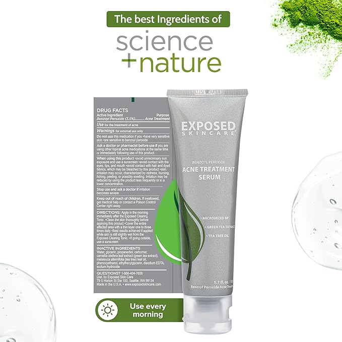 Exposed Skin Care, Acne Treatment Serum with 3.5% Benzoyl Peroxide – Lightweight Acne Spot Treatment – Quickly Clear Teen, Adult, Hormonal and Cystic Acne – Natural, Non-toxic and Cruelty Free