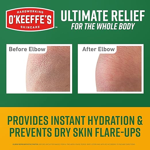 O’Keeffe’s Skin Repair Ultimate Relief Body Cream, 7oz Tube (Pack of 1) – for The Most Severe Dry Skin
