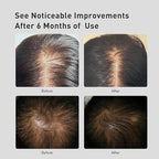 KINTOR 0.5% 0.9% KX-826 Hair Regrowth Spray,Reduce Fuller-looking Healthier Hair,Oil Control, Hair Care Products Group for Men&Women,3 Bottles, Basic,Plant-Based,Pro