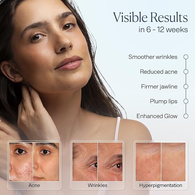 VogueNow LED Light Therapy Mask With Chin & Lip Coverage - FDA-Cleared Device for Wrinkles & Acne - Red Blue Near Infrared Light Therapy for Face - Anniversary Christmas Gifts for Women Mom Wife