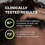 Scandinavian Biolabs Bio-Pilixin® Serum For Men | Helps Reduce Hair Loss Due to Breakage, Help Activate Hair Growth, Stem Cell Technology, Drug-Free Daily Use, Clinically Tested, 100 mL/ 3.4 Oz