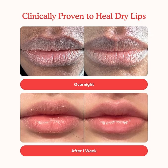 Tower 28 LipSoftie Hydrating Tinted Lip Treatment Balm, Moisturizing Lip Mask for Chapped Lips - Blood Orange Vanilla Flavor, Sheer Red Orange Gloss