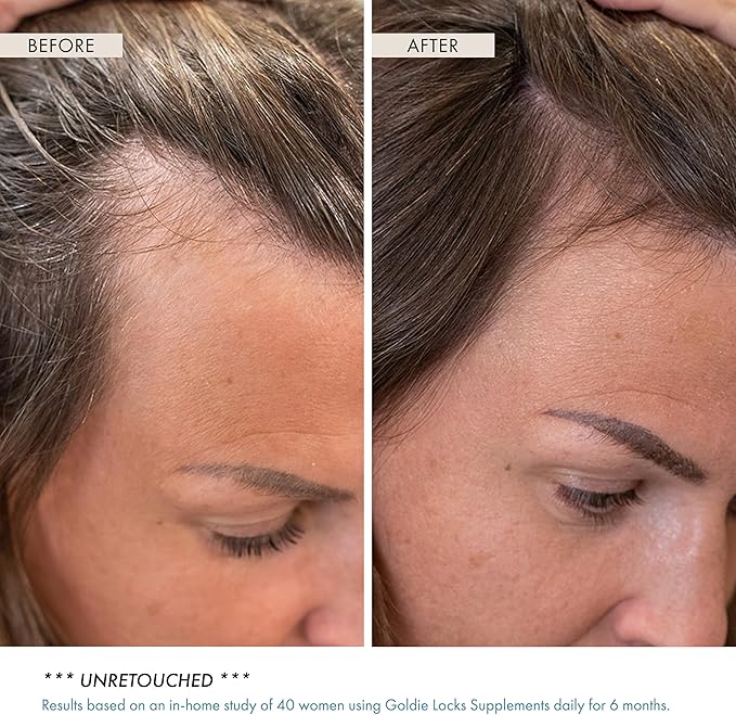 Goldie Locks Hair Growth Supplements Refill - Original Formula - Supports Hair, Skin, Nails & Joints - with Biotin, Multi-Collagen, Zinc & Adaptogenic Herbs - Daily Beauty Supplement - 120 Count