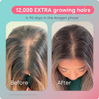 Biosil Advanced Hair Growth Formula - 30 Packets - Promotes Hair (re) Growth, Prevents Hair Loss and Shedding & Increases Thickness and Strength - with Patented ch-OSA - 1 Month Supply