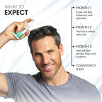 AM/PM Hair Growth Serums for Women & Men – Redensyl Capixyl Procapil GHK-CU Multi-Peptide & Stem Cell Formula| DHT Blocker Topicals | Regrowth Treatment | Hair Loss Support Bundle | Follicle Spray