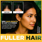 PREMIUM Cold-Pressed Batana Oil for Hair Growth, 100% Pure & Organic, No Burnt Smell, Hair Mask from Honduras, Fade Stretchmarks, All Natural