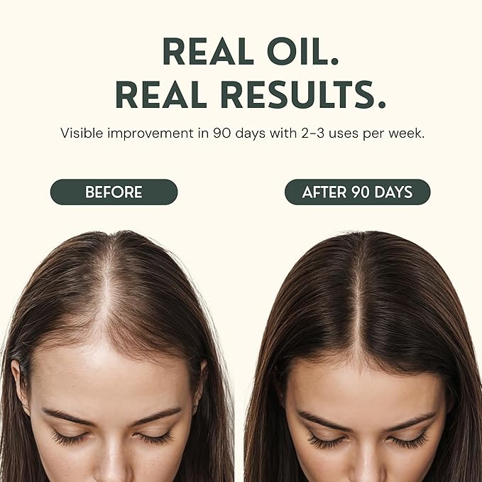 Batana Oil for Hair Growth - 4oz - 100% Pure, Cold Pressed, Unrefined Oil from Honduras - Supports Stronger & Thicker Hair - Dr Sebi Inspired Hair Growth Treatment