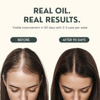 Batana Oil for Hair Growth - 4oz - 100% Pure, Cold Pressed, Unrefined Oil from Honduras - Supports Stronger & Thicker Hair - Dr Sebi Inspired Hair Growth Treatment