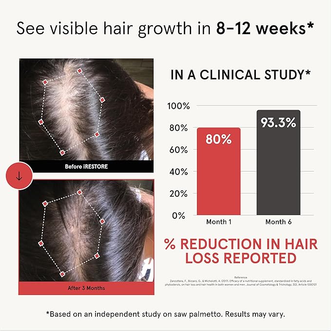 iRestore Hair Growth Supplement – Natural DHT Blockers & Multivitamin Blend – Vegan, Non-GMO, 90 Capsules – Supports Thicker, Stronger Hair for Men and Women – 3-Pack