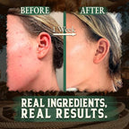 Organic Beef Tallow for Skin -2OZ (Eucalyptus, Concentrated) — Grass Fed Beef Tallow for face + Body — US-Made Tallow and Honey Balm Moisturizer for Dry & Sensitive Skin,Eczema,Rosacea (No Additives)