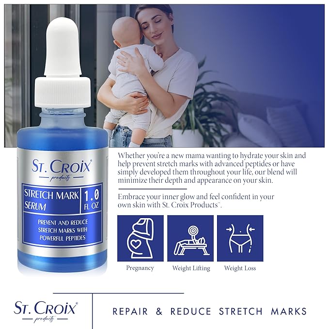 Stretch Mark Serum - Prevent and Reduce Appearance of Stretch Marks - 1 oz