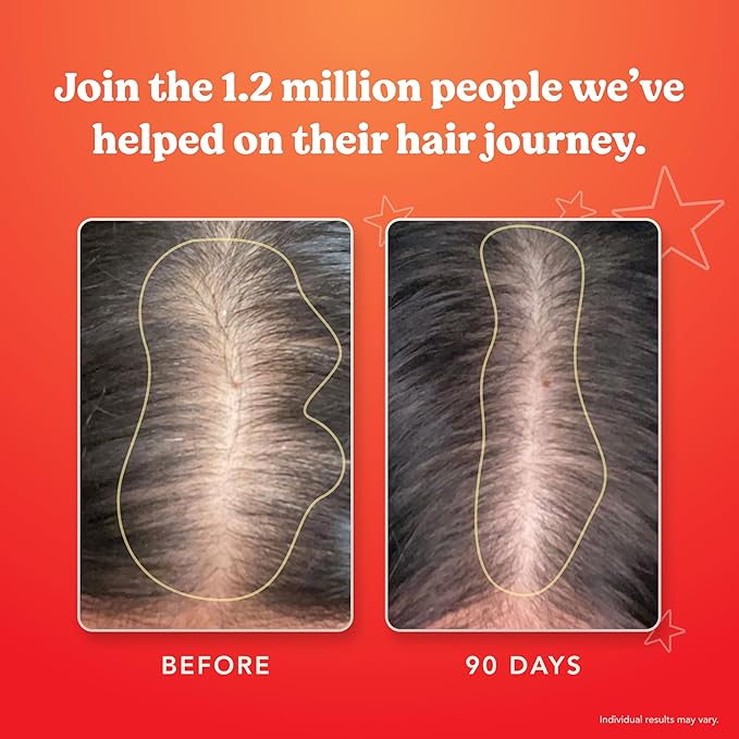 HAIRtamin Advanced Formula Hair Vitamins, Growth Supplement for Women & Men, Supports Stronger, Longer, Visibly Thicker Hair, With 5000 mcg Biotin, Vitamins & Antioxidants, 100% Vegan - 1 Month Supply