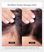 Invigorating Shampoo - Hair Growth Shampoo for Women & Men with Human Stem Cell Extract – Cleanses, Strengthens & Moisturizes to Support a Healthier Scalp & Fuller-Looking Hair - 8 oz