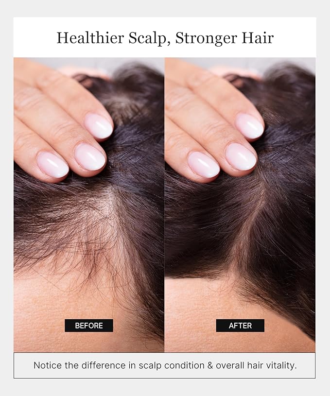 Invigorating Shampoo - Hair Growth Shampoo for Women & Men with Human Stem Cell Extract – Cleanses, Strengthens & Moisturizes to Support a Healthier Scalp & Fuller-Looking Hair - 8 oz