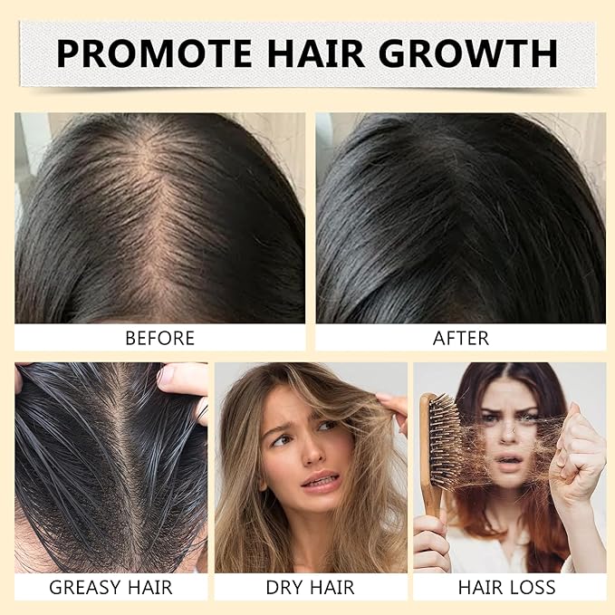 Batana Oil for Hair, 4-in-1 Liquid Batana Oil, with Rosemary, Pumpkin Seed Oil, Castor Oil, for Men and Women, Prevents Dry Hair & Hair Loss for All Hair Types (1Pcs)