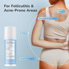 Folliculitis Acne Lotion for Body: Helps Reduce Itch, Redness, Body Acne, Bumps & Uneven Texture with Salicylic & Glycolic Acid + Botanicals - Gentle Care for Folliculitis-Prone Skin