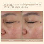 SHANI DARDEN Intensive Eye Renewal Cream, Hydrating Under Eye Cream for Dark Circles, Fine Lines, Wrinkles & Crows Feet with Niacinamide, Shea Butter & Ceramide, Crease-Free & Makeup-Ready, 0.50 fl oz