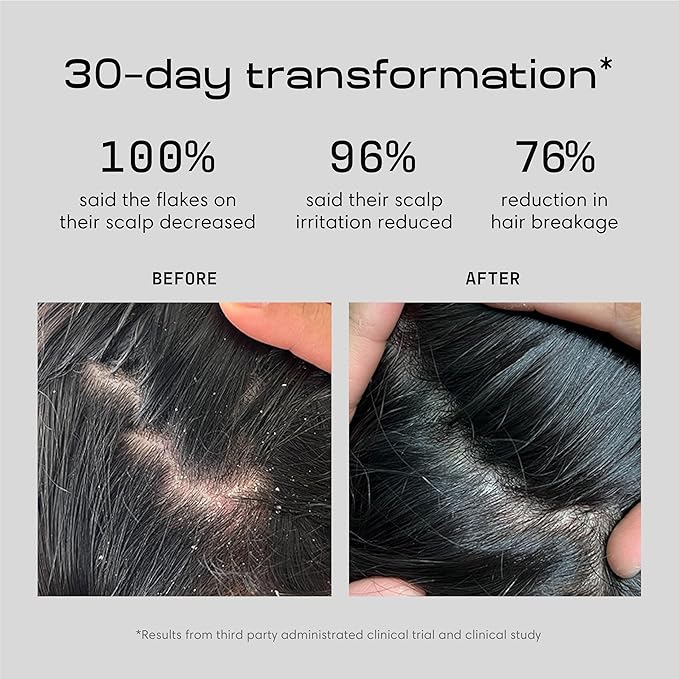 Jupiter Anti Dandruff Shampoo, Conditioner, & Scalp Scrubber for Flaky, Itchy & Dry Scalp - Hydrates & Reduces Flakes - Scalp Treatment & Hair Care Set - Color-Safe, Sulfate-Free, Paraben-Free