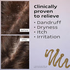 KAMEDIS Scalp Moisturizer Lotion For Dry, Itchy, Dandruff, Flaky, Seborrheic Dermatitis, Psoriasis and Sensitive Scalp. Over-Night Mask Treatment Botanicals-Based. Parabens Free. 3.38 Fl Oz.