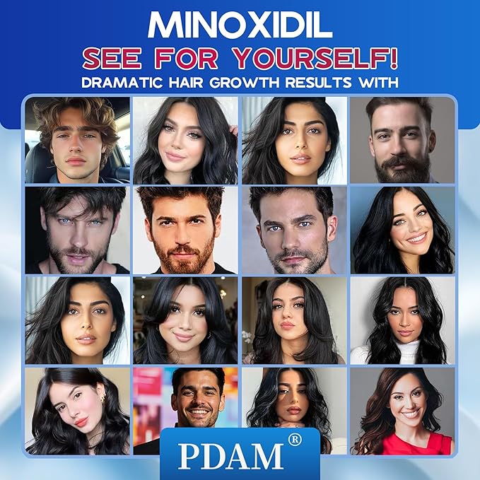 5% Minoxidil for Men and Women Foam Hair Growth - Minoxidil Foam Hair Regrowth Treatment for Men and Women, Topical Hair Loss Treatments, Extra Strength Thicker & Fuller Hair, 2 x 2.11 oz for 2 Months