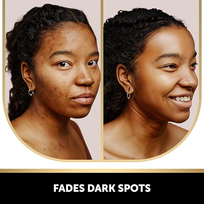 VALITIC Kojic Acid Vitamin C and Retinol Soap Bars with Turmeric for Dark Spot - Original Japanese Complex Infused with Collagen, Hyaluronic Acid, Vitamin E (2 Pack) - With Scrub Bag