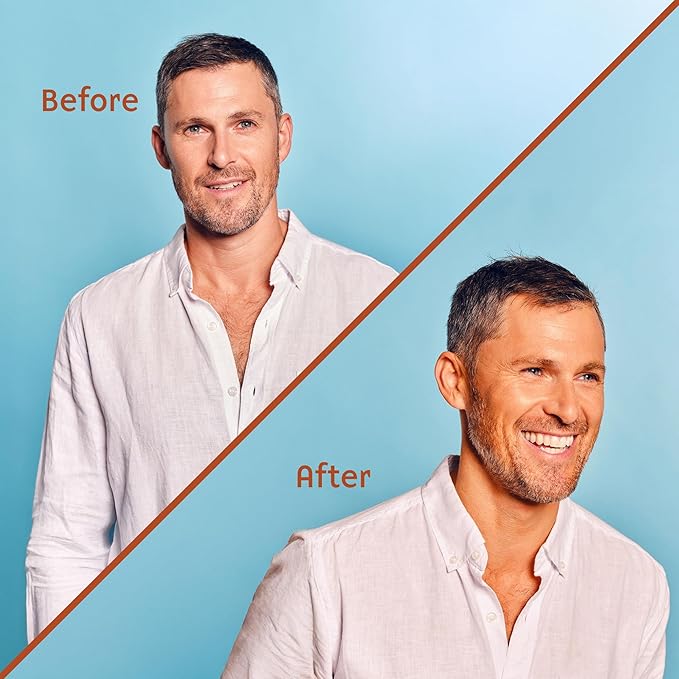 Face Tan Mist - Self Tanning Mist, Waterproof, Effortless and Natural Looking, Gradual Sun Kissed Glow, Suitable for Face and Body, Hydrating Moisturiser with Vitamin C and Vitamin E