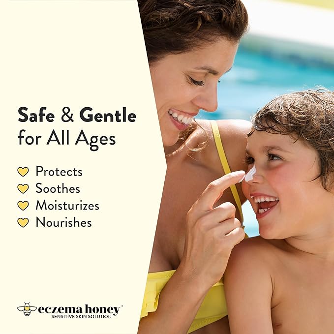 Eczema Honey Hydrating Mineral Sunscreen - Lightweight SPF 30 Sun Cream - Body & Face Sunscreen for All Ages (1.7 Oz)